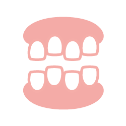 デコボコ歯 （叢生 そうせい）